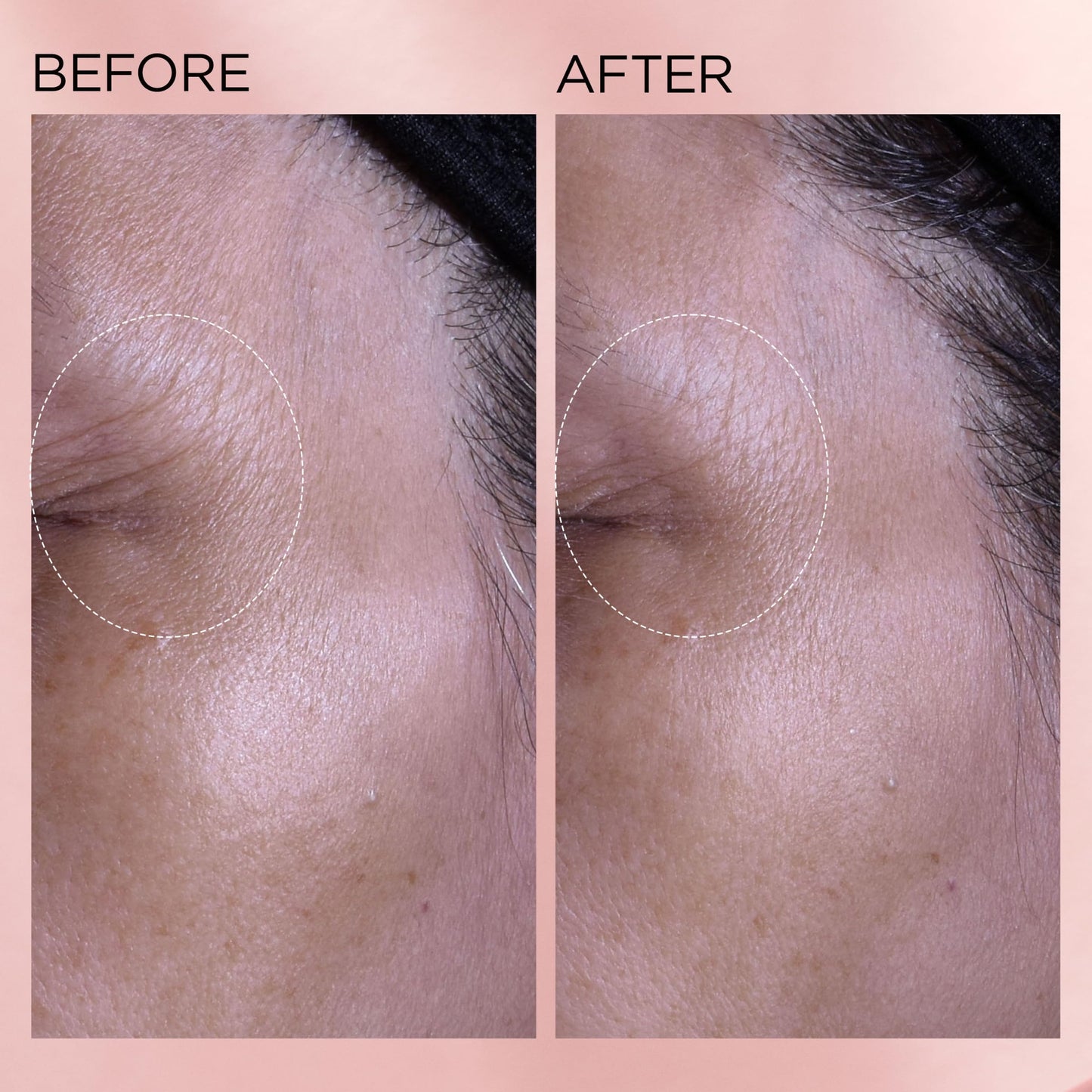 Elizabeth Arden Retinol + HPR Ceramide Rapid Skin Renewing Water Cream Face Moisturizer, Anti-Aging Wrinkle Treatment, Niacinamide, Hyaluronic Acid, Ceramides & Peptides, 1.7 fl oz - Medaid International