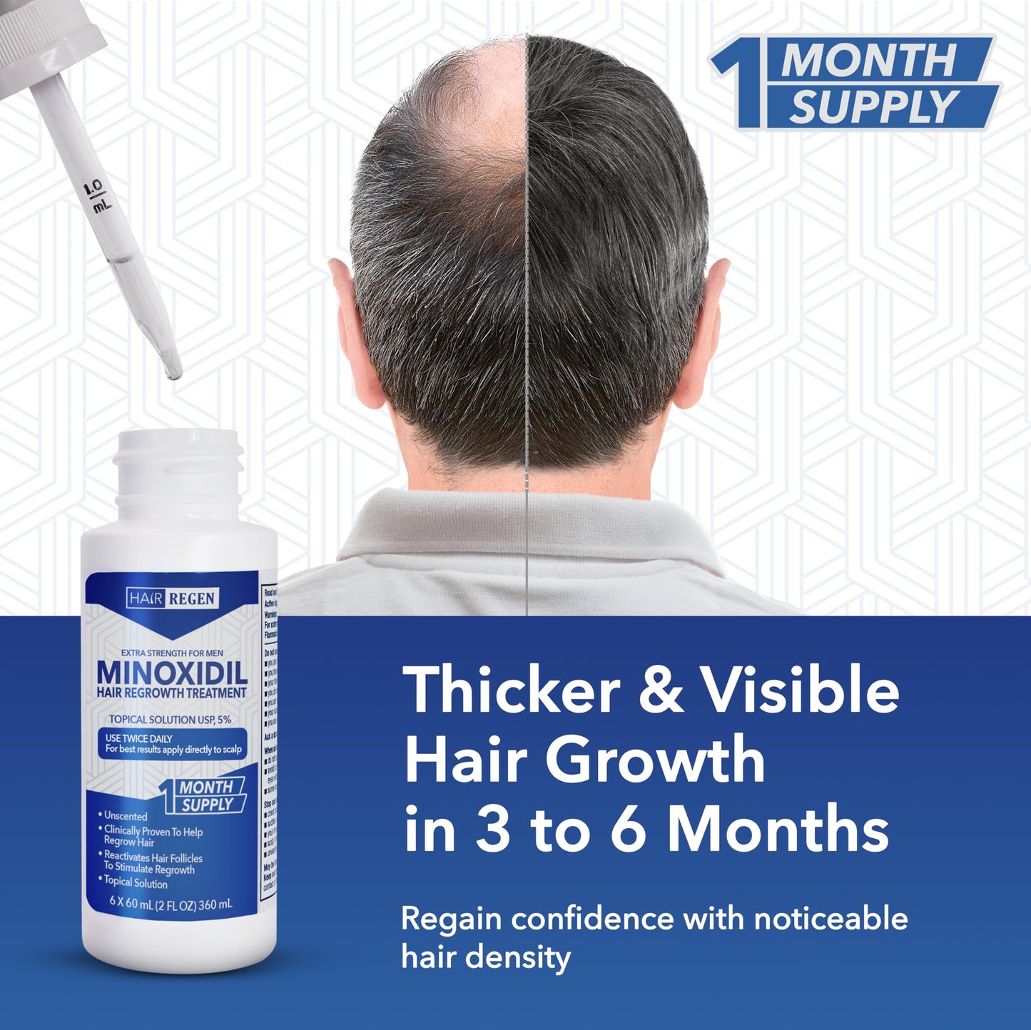 Hair-Regen Advanced 5% Minoxidil For Men Hair Regrowth Treatment for Thinning Hair - Hair Loss for Men - 6 Month Supply, Minoxidil Topical Solution So Thicker Fuller Hair Keeps Growing Amazing Results - Medaid International