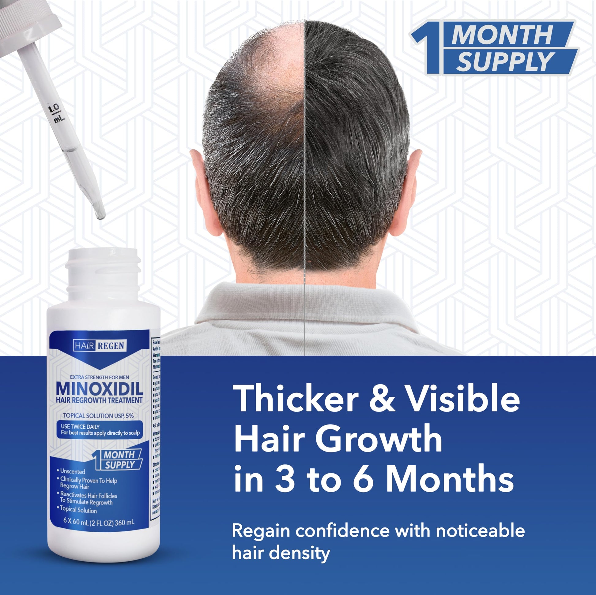 Hair-Regen Advanced 5% Minoxidil For Men Hair Regrowth Treatment for Thinning Hair - Hair Loss for Men - 6 Month Supply, Minoxidil Topical Solution So Thicker Fuller Hair Keeps Growing Amazing Results - Medaid International