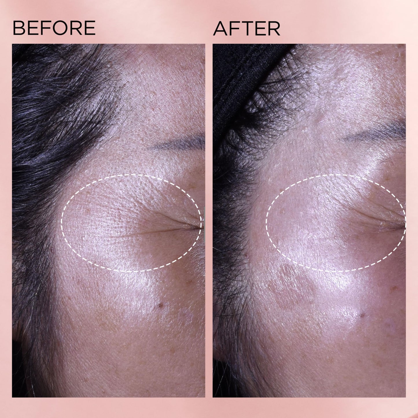 Elizabeth Arden Retinol + HPR Ceramide Rapid Skin Renewing Anti-Aging Face Serum Capsules, Fine Lines & Wrinkles Treatment with Peptides, Vitamin E, & Niacinamide, 60 Count - Medaid International