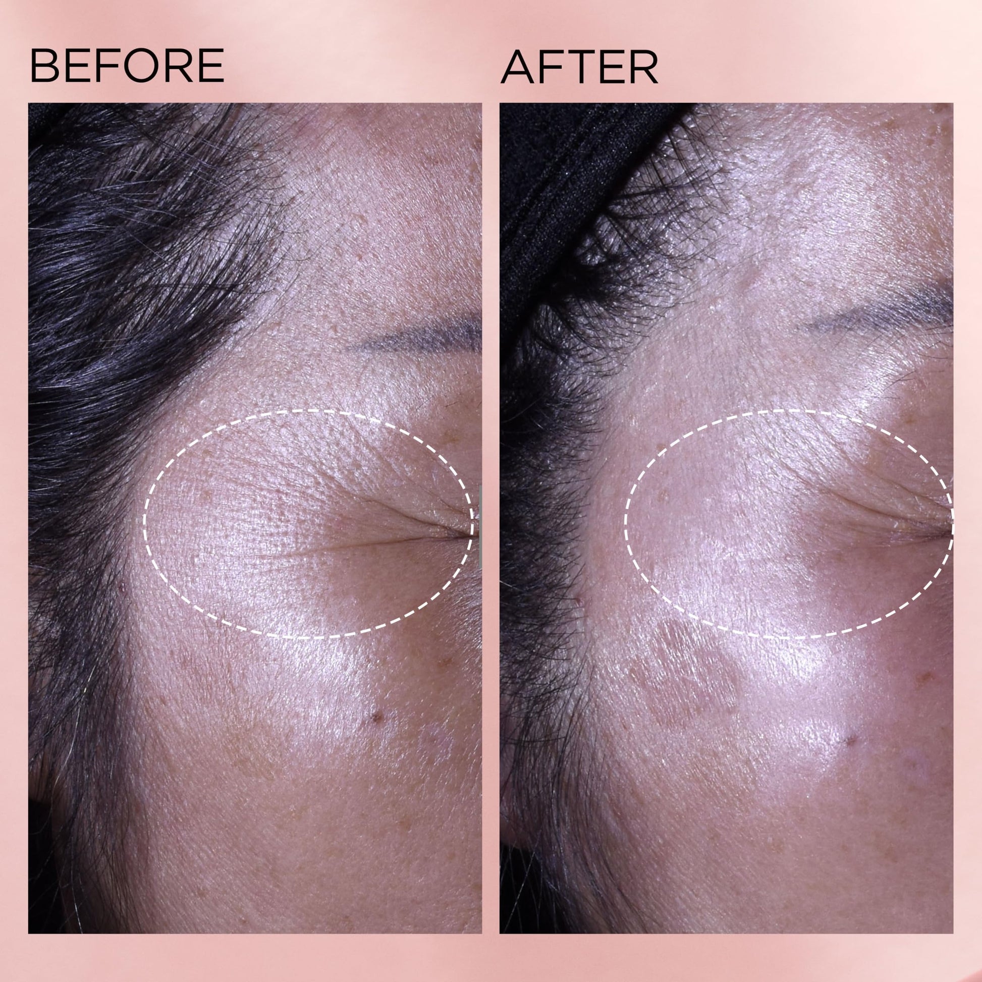 Elizabeth Arden Retinol + HPR Ceramide Rapid Skin Renewing Anti-Aging Face Serum Capsules, Fine Lines & Wrinkles Treatment with Peptides, Vitamin E, & Niacinamide, 60 Count - Medaid International