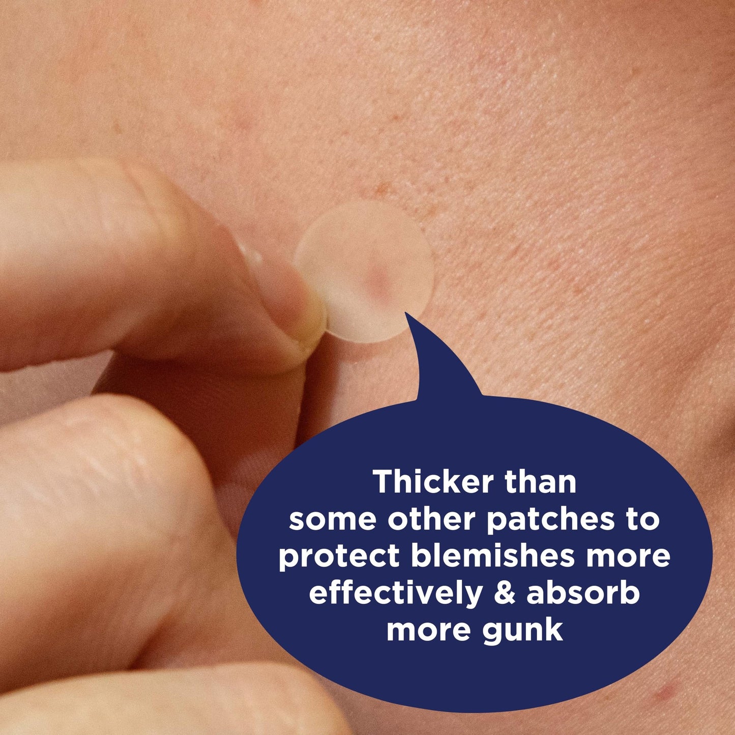 PanOxyl PM Overnight Spot Patches, Advanced Hydrocolloid Healing Technology, Fragrance Free, 40 Count Pack of 1 - Medaid International