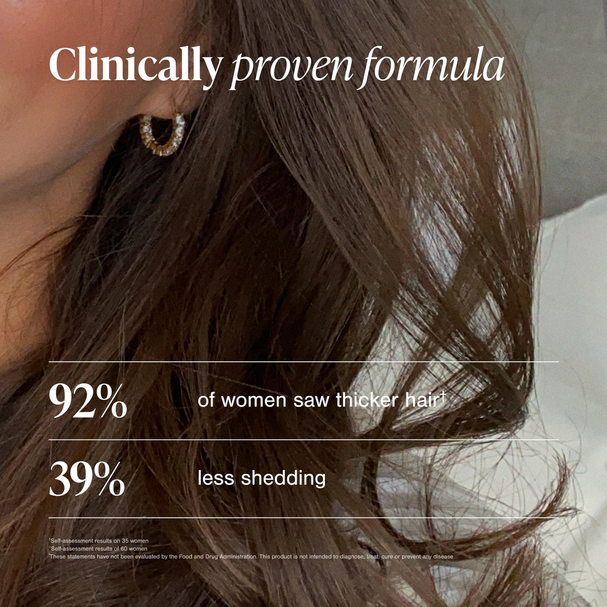 Viviscal Hair Growth Supplements For Women For Thicker, Fuller Hair, Nourishes Thinning & Loss, With Proprietary Collagen Complex, 60 Tablets, 1 Month Supply - Medaid International