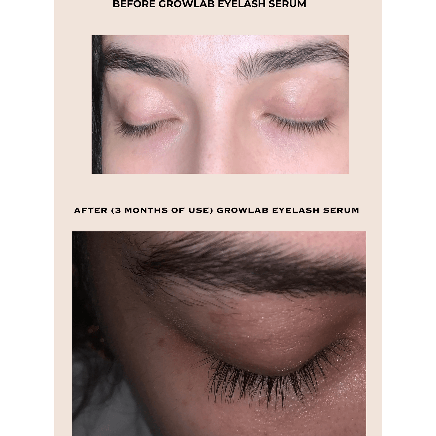 GROWLAB Eyelash Serum - Medaid
