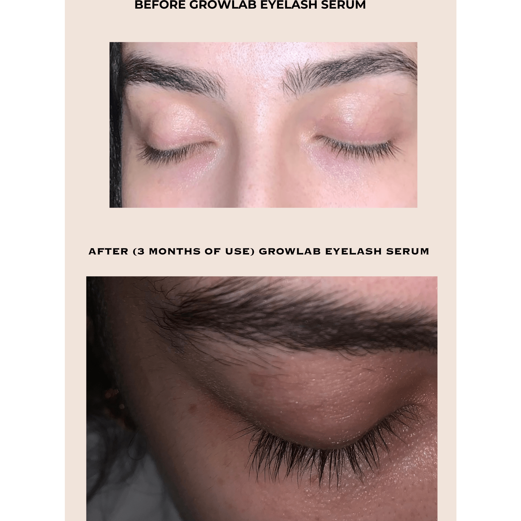 GROWLAB Eyelash Serum - Medaid