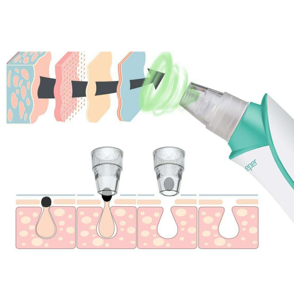 Rechargeable Pore Vacuum And Black Head Remover - Medaid International