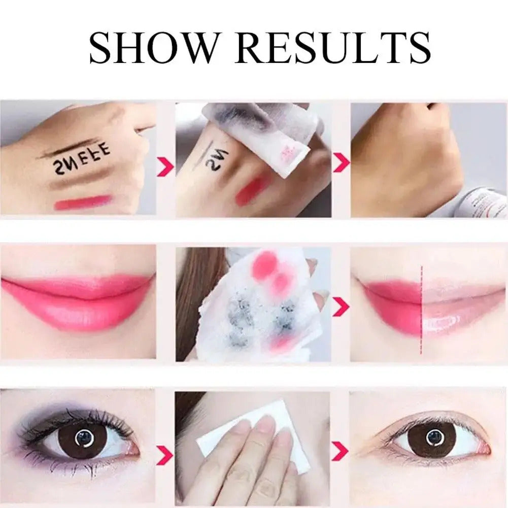 Makeup Remover Wipes (80 wipes) - Medaid International