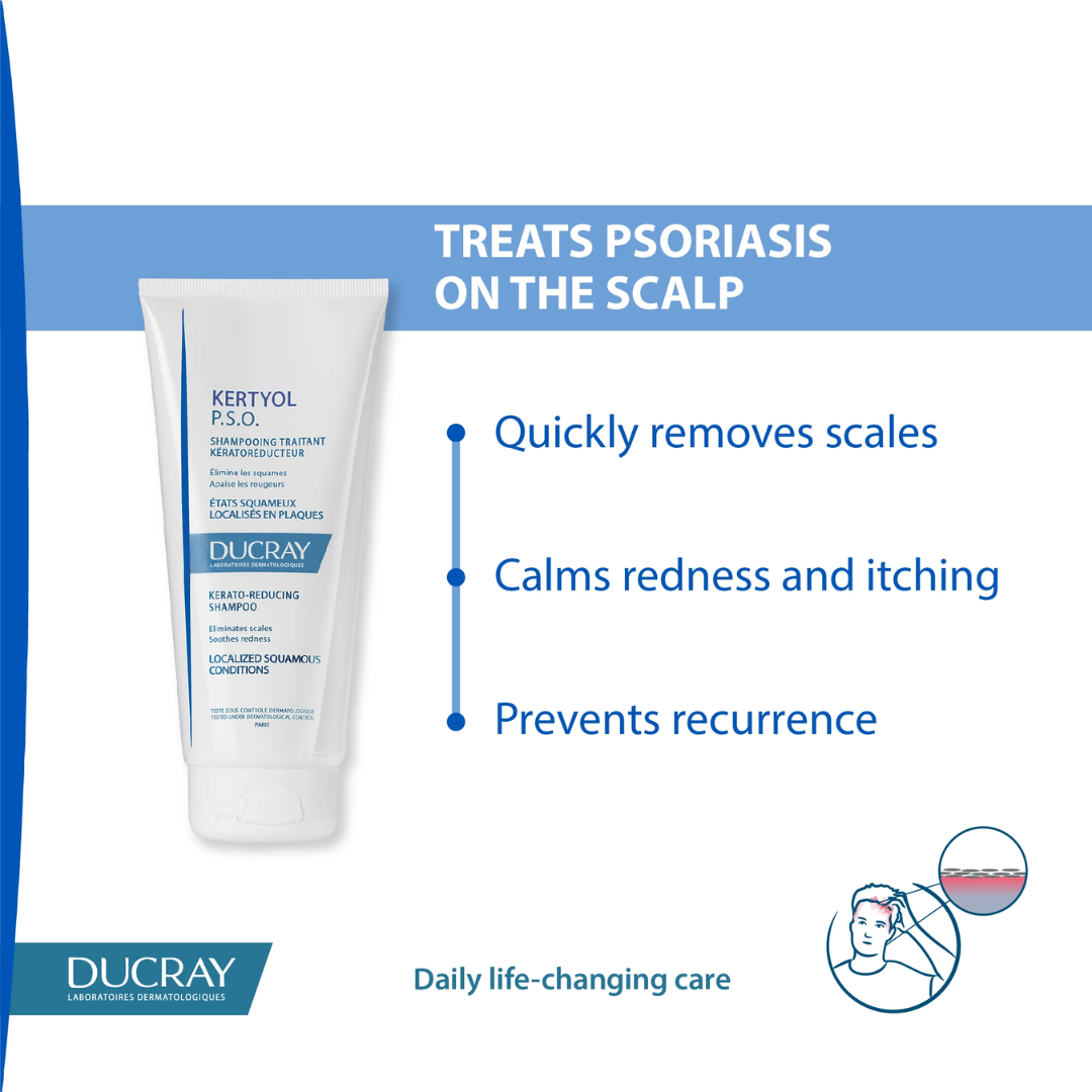 Ducray Kertyol Psoriasis Kerato-Reducing Shampoo 200ml