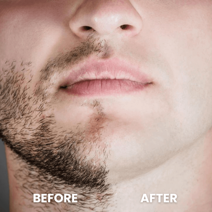 VGR® Electric Razor | Small & Portable - Medaid International