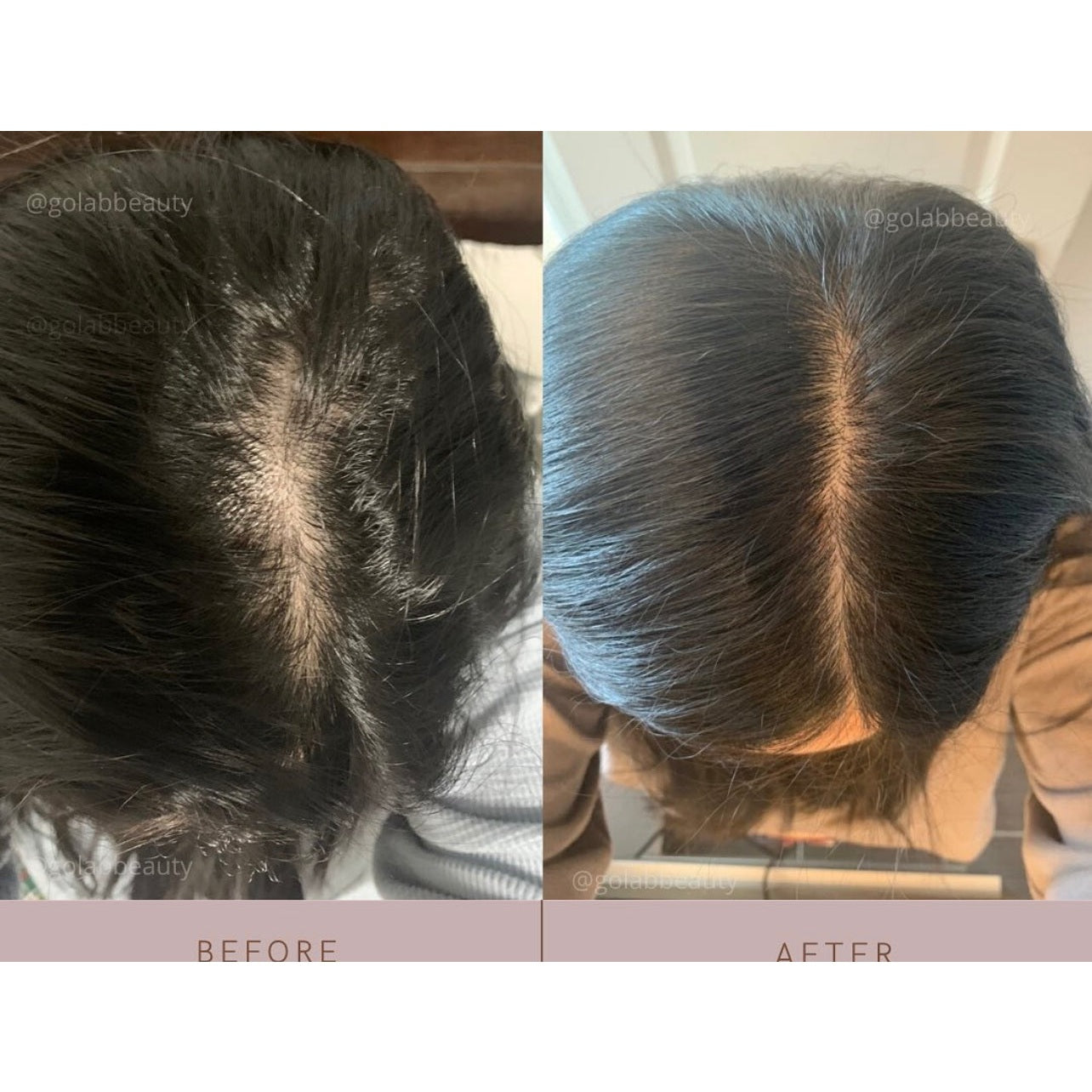 Strengthening Scalp Massage Oil - Medaid