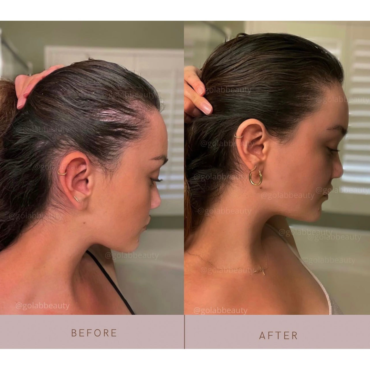 Strengthening Scalp Massage Oil - Medaid