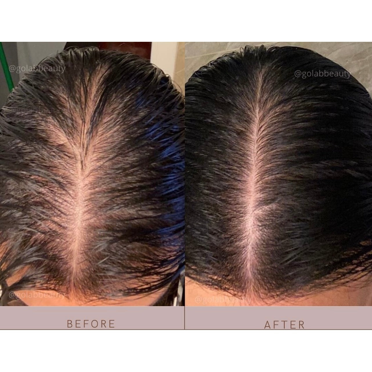 Strengthening Scalp Massage Oil - Medaid