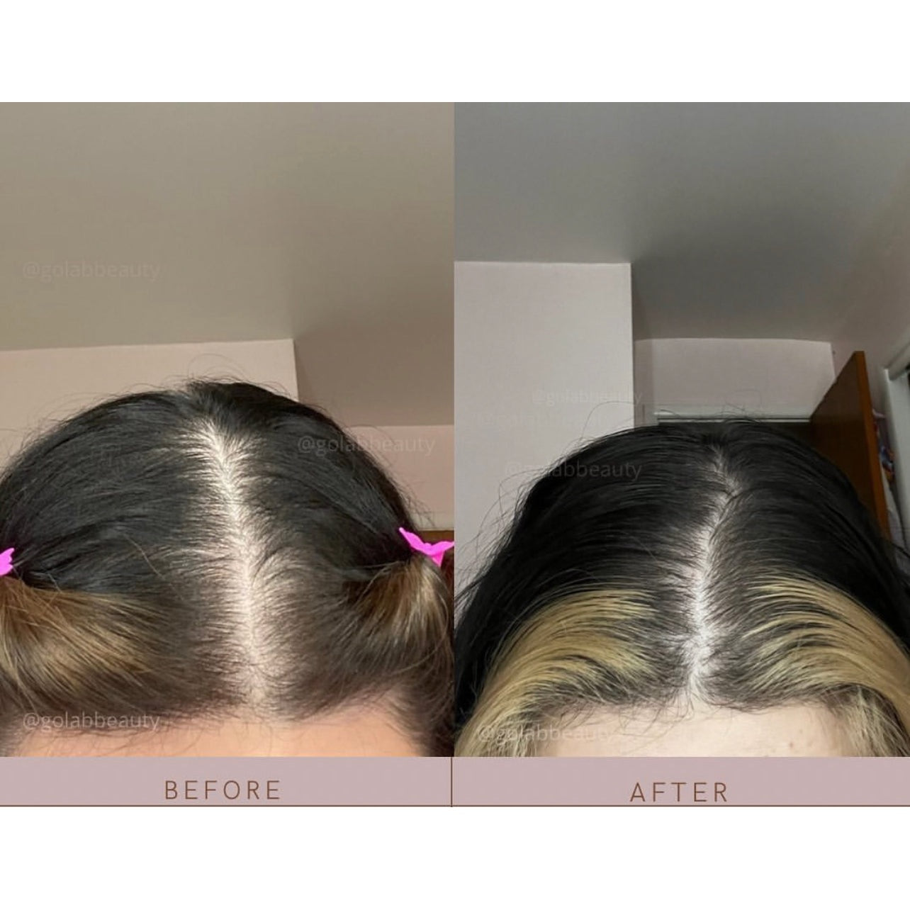 Strengthening Scalp Massage Oil - Medaid