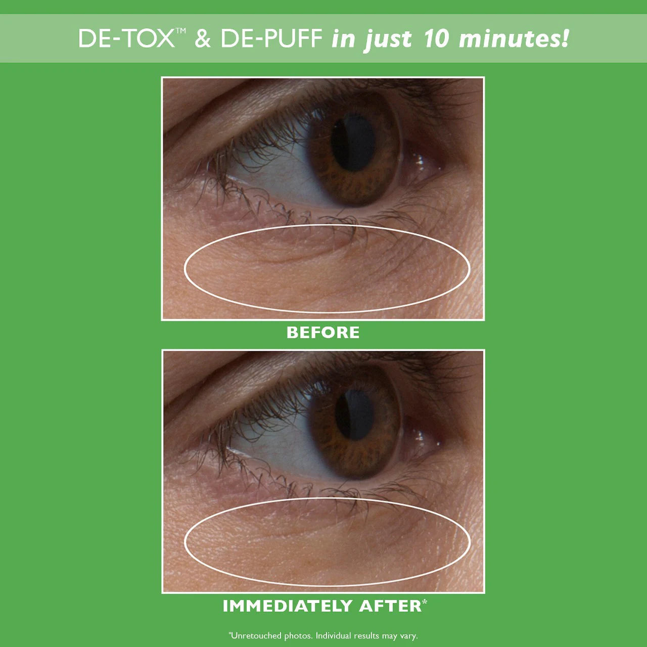 PETER THOMAS ROTH - CUCUMBER DETOX EYE PATCHES | 60 Pads-30 Treatments - Medaid