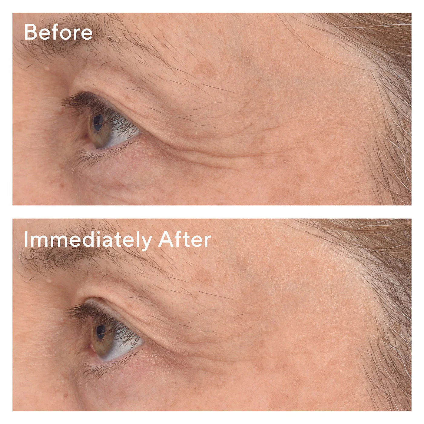 Murad - Retinol Youth Renewal Eye Masks | 1 Pair - Medaid