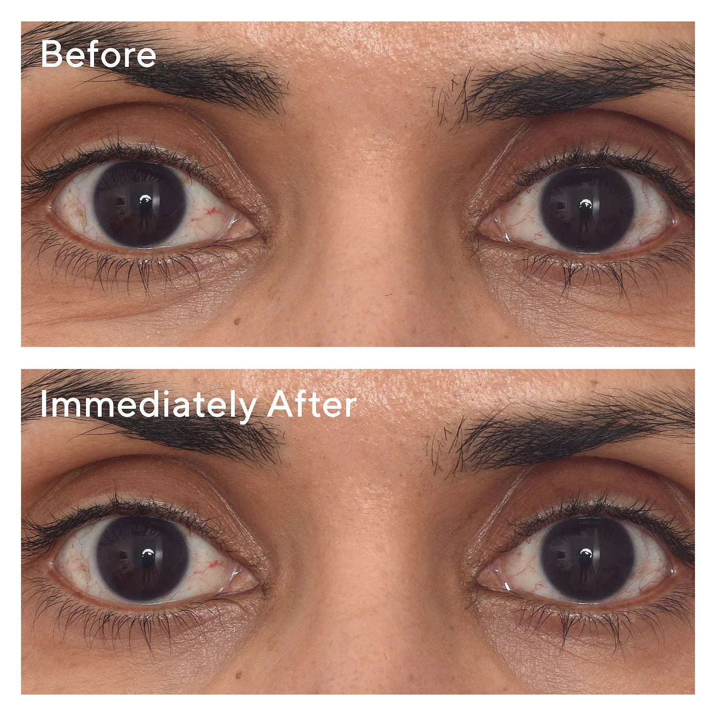 Murad - Retinol Youth Renewal Eye Masks | 1 Pair - Medaid