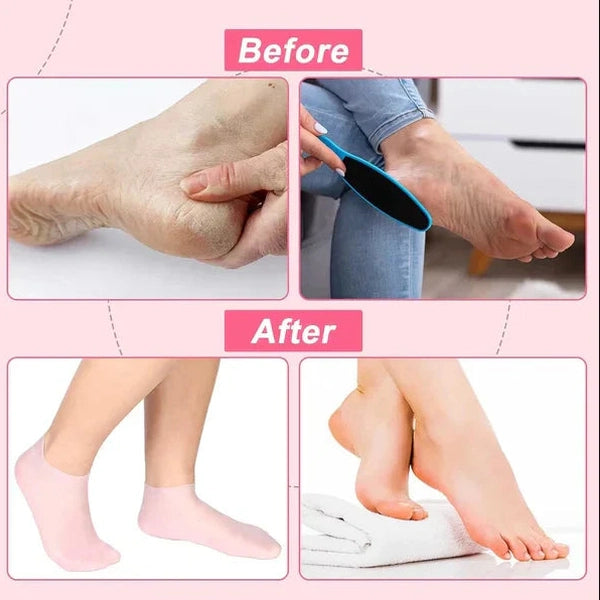 Silicone Gel Socks Pair - Medaid International