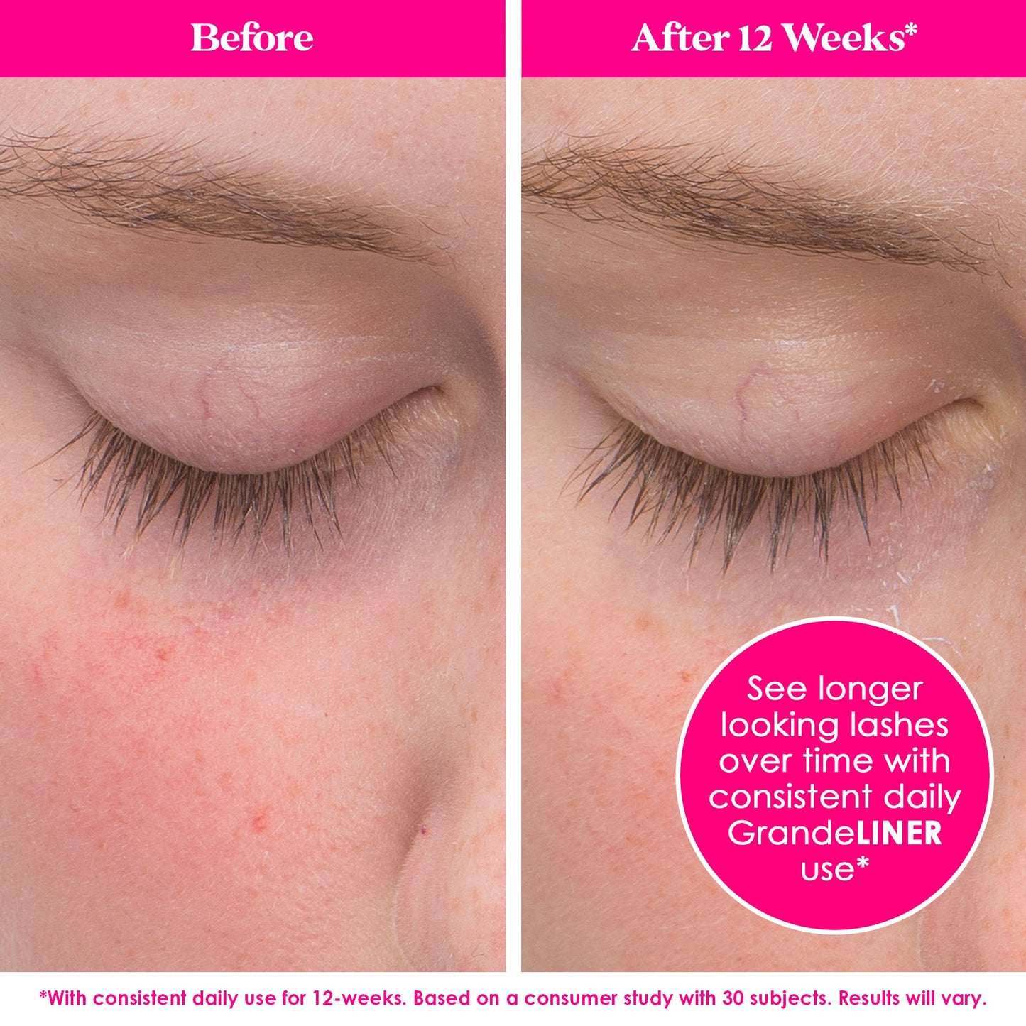 Grande Cosmetics - Mini Lash Envy Lash Enhancing Serum and Liquid Eyeliner Set - Medaid