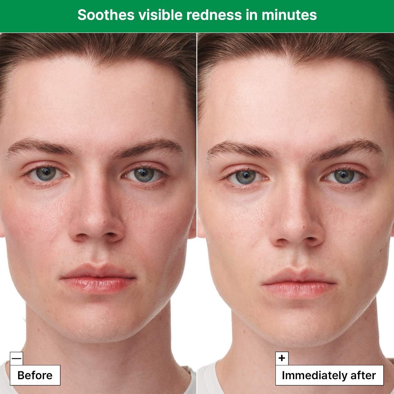 Dr. Jart+ - Cicapair ™ Sensitive Skin Serum Face Mask for Redness - Medaid