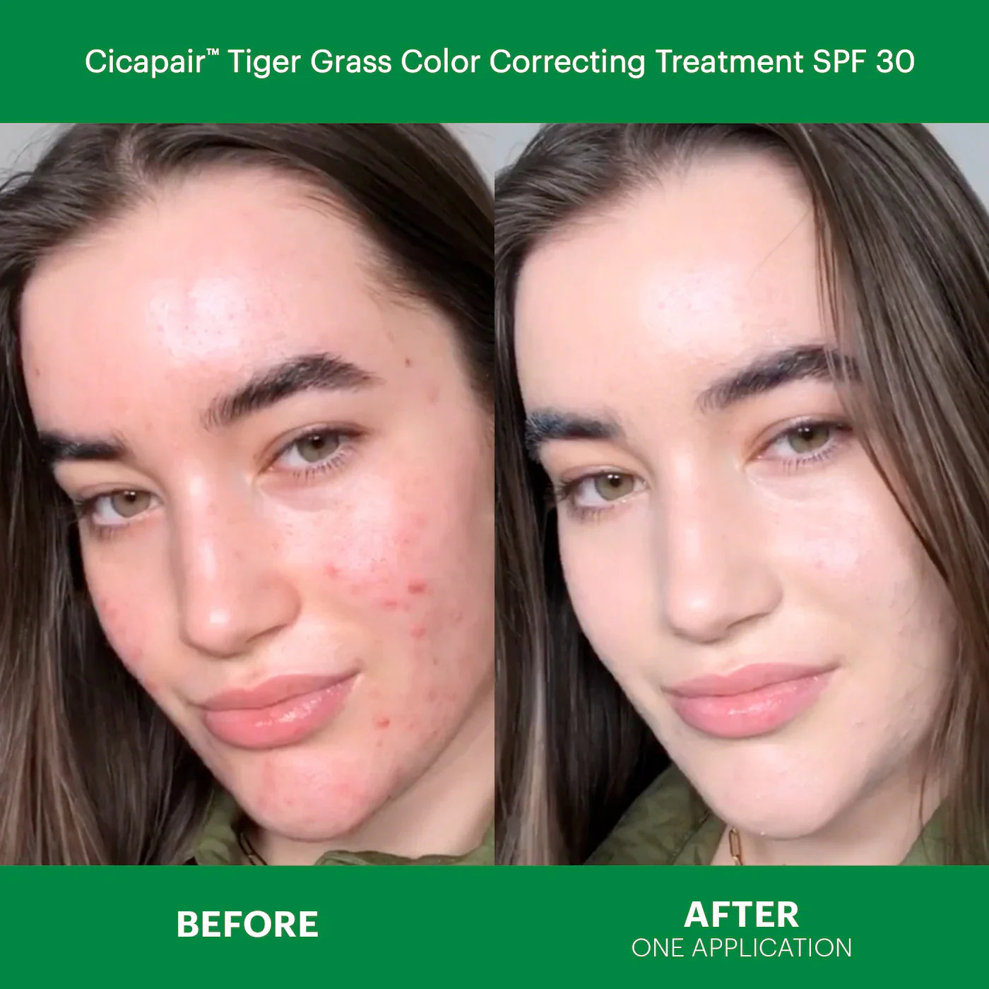 Dr. Jart+ - Cicapair™ Redness Rescue Kit for Sensitive Skin - Medaid