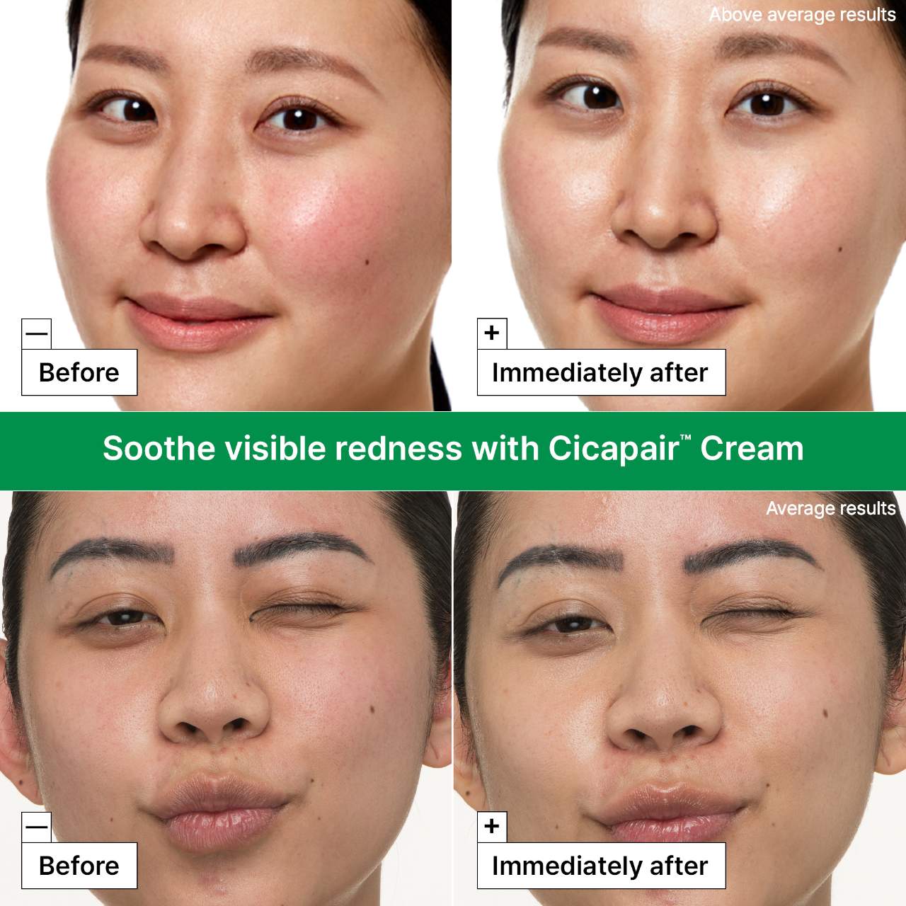 Dr. Jart+ - Cicapair™ Redness Rescue Kit for Sensitive Skin - Medaid