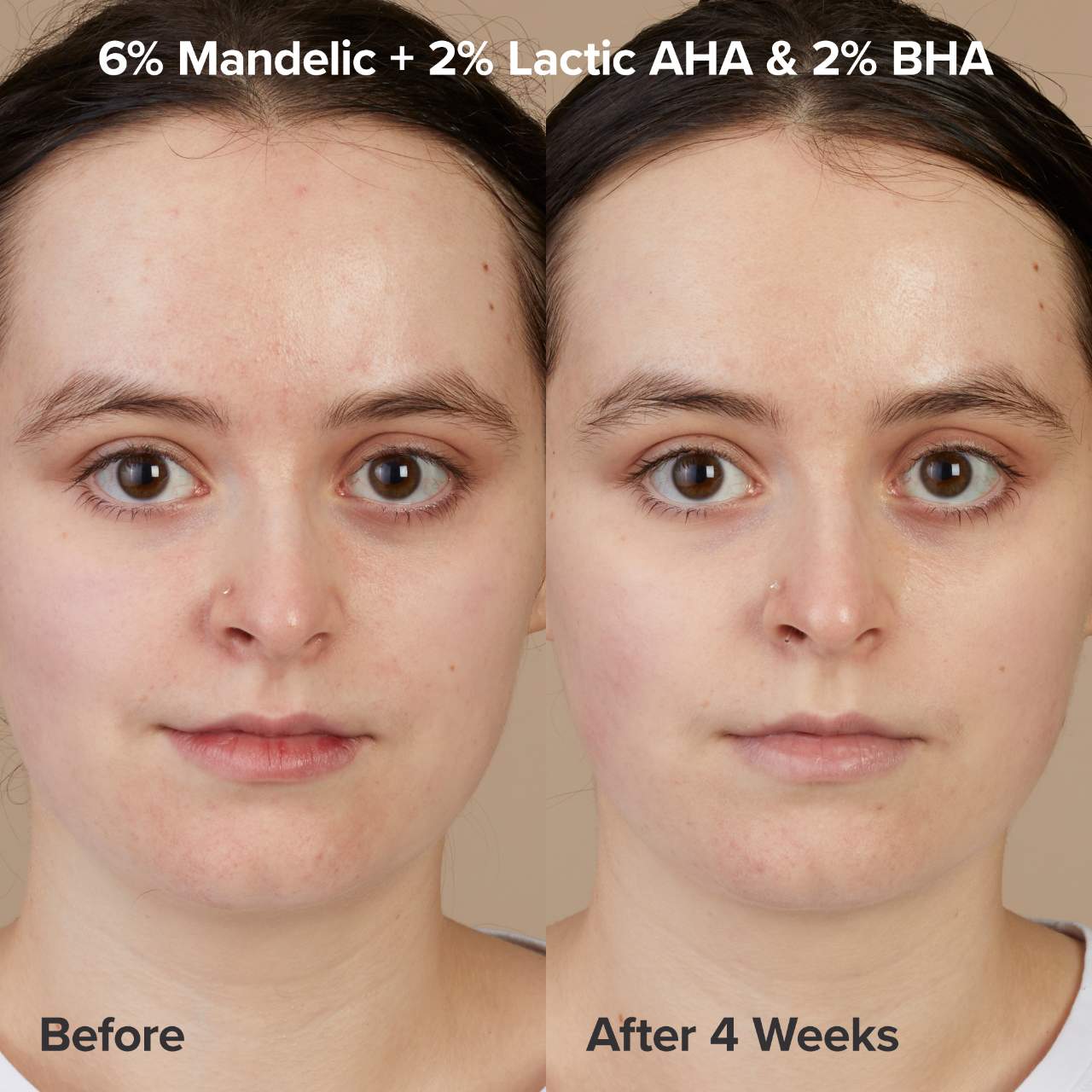 Paula's Choice - The Exfoliation Experience Kit with 2% BHA + 6% Mandelic Acid AHA - Medaid