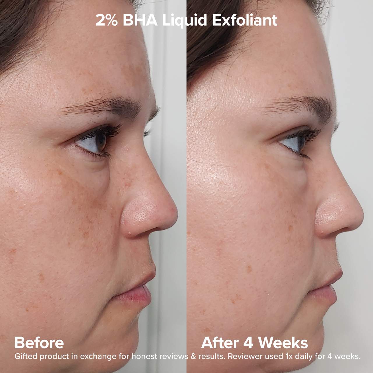 Paula's Choice - The Exfoliation Experience Kit with 2% BHA + 6% Mandelic Acid AHA - Medaid